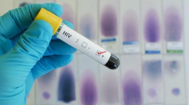 Grande passo para cura da AIDS é dado por cientistas nos EUA-0