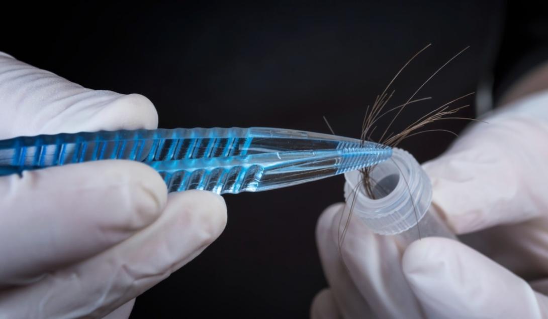 Cientistas conseguem criar folículos capilares em pele cultivada em laboratório-0